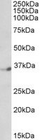 EB05827 1