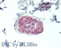 EB05259-T 4