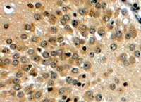 EB07031 1