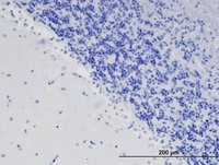EB08861 1