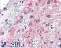 EB06825 2