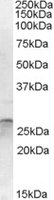 EB08654 1