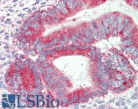 EB11413 3