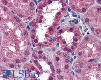 EB09509 3