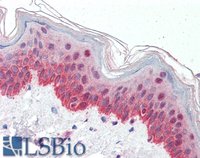 EB07666 2