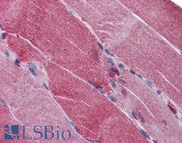 EB08962 2
