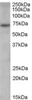 EB06547 1