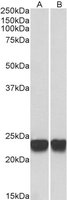 EB05880-T 1