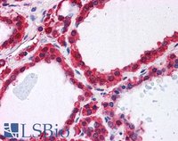 EB05880-T 4