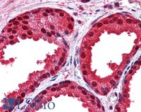 EB05880-T 5