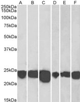 EB05880-T 2
