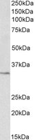 EB11651 3