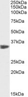 EB11651-B 1