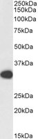 EB11650-B 1