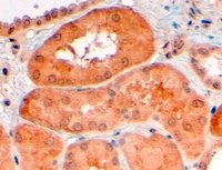 EB06682 2