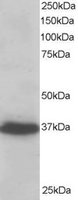 EB06249 1