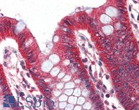EB07727 2