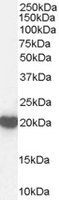 EB07284-T 1