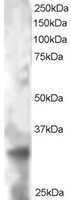 EB05430 1