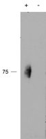 EB03004 1