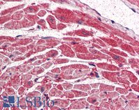 EB07512 2