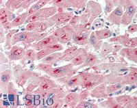 EB10892 2