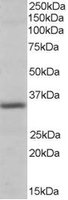 EB06437 1