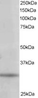 EB06319 1