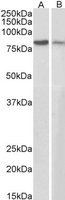 EB05500 1