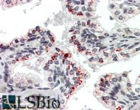 EB08421 1