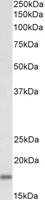 EB08421-B 1