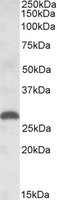 EB09599 1