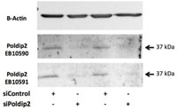 EB10591 2