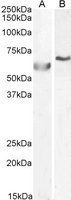 EB06206 1