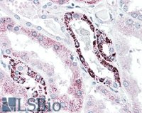 EB12012 2