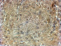 EB09836 1