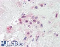 EB09835 2