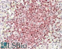 EB10018 2