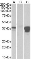 EB10017 1