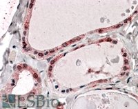 EB06717-T 2