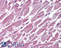 EB06717-T 3