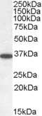 EB05230 1