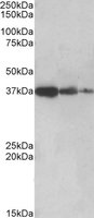 EB09407 1
