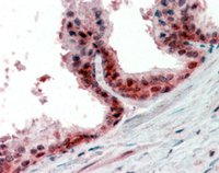 EB09395 3