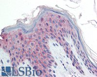 EB10317 2