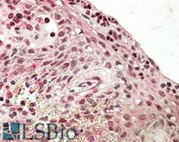 EB09715 2