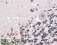 EB07166 1