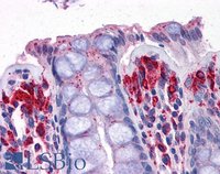 EB07166 3