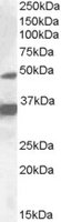 EB09172 1