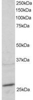 EB05574 1